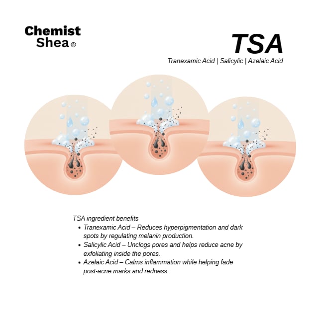 Mixtrue Beauty Chemist Shea Acne & Blemish Cleanser | with Niacinamide, Salicylic Acid, Tranexamic Acid & Azelaic Acid